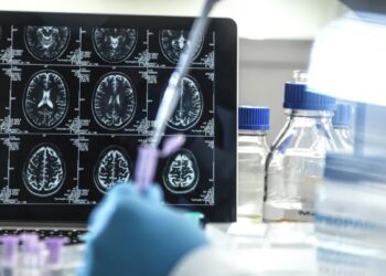 Estudo sugere que forma muito rara de Alzheimer pode ser transmissível