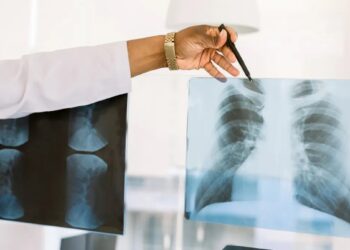 Conheça os principais exames para a detecção precoce do Câncer