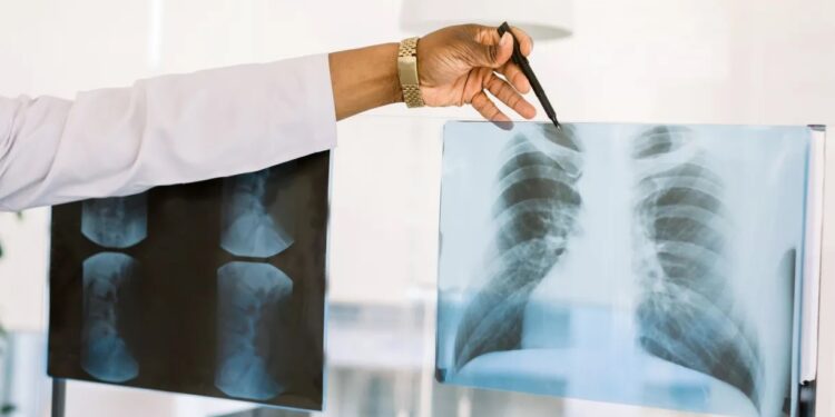 Conheça os principais exames para a detecção precoce do Câncer