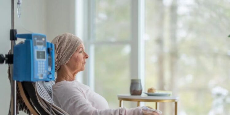 Tratamento para Alzheimer pode melhorar efeitos causados pela quimioterapia