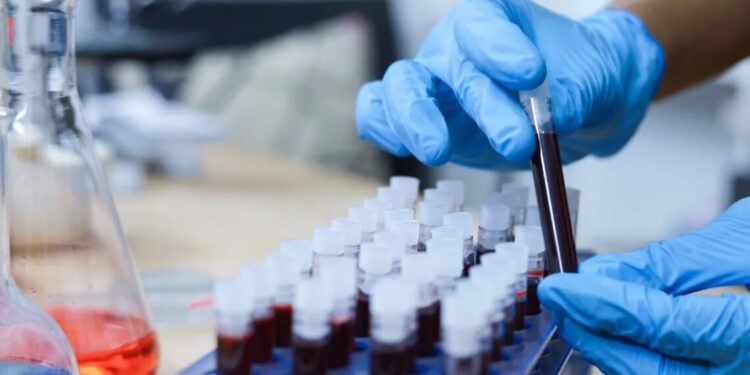 Exame de sangue com IA realiza detecção precoce de nove tipos de câncer