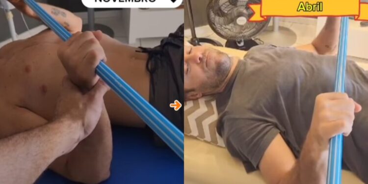 Kayky Brito compartilha antes e depois da fisioterapia 7 meses após acidente