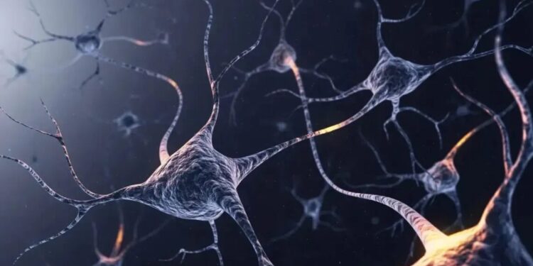 Alzheimer pode avançar mais rápido em pessoas com síndrome de Down