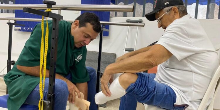 Governo do Tocantins entrega próteses para pacientes de Araguaína e região