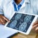 Nova vacina para câncer potencializa resposta imune contra tumor cerebral