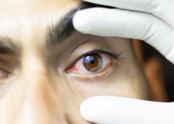 O melanoma, um dos tipos de câncer mais agressivos, tem se mostrado um desafio, por conta da melanina, um pigmento escuro que compete com o medicamento fotossensibilizador pela absorção da luz