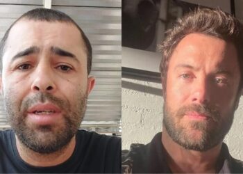 Kayky Brito admite erro em acidente e agradece motorista que o atropelou Reprodução/Instagram