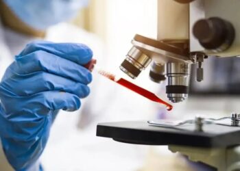 Cientistas descobriram proteínas presentes no sangue que podem estar relacionadas ao desenvolvimento de câncer Thana Prasongsin/Getty Images