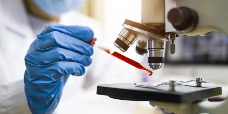 Proteínas encontradas no sangue podem indicar câncer com 7 anos de antecedência