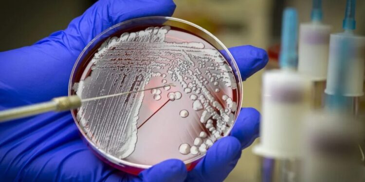 Conheça as 15 bactérias mais perigosas para a saúde humana, segundo a OMS