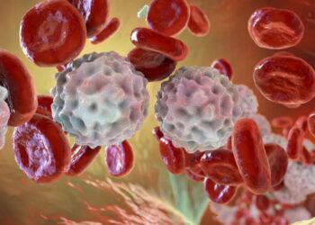 Na LLC, os linfócitos (glóbulos brancos) se tornam cancerosos e, de forma lenta e progressiva, substituem as células saudáveis nos linfonodos