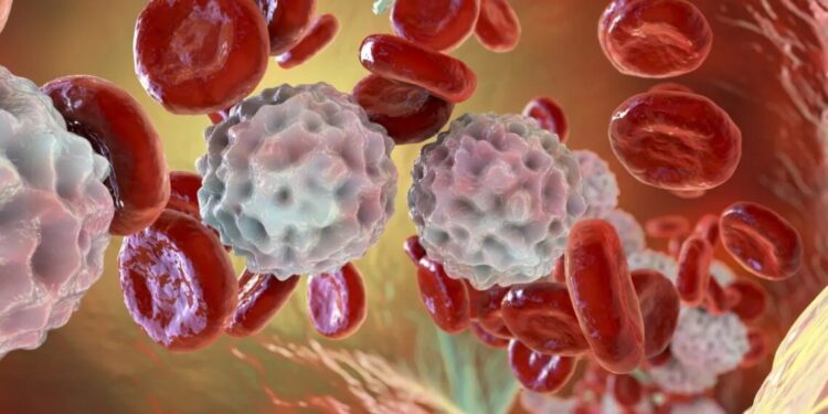 O que é leucemia linfocítica crônica? Conheça sintomas e tratamento