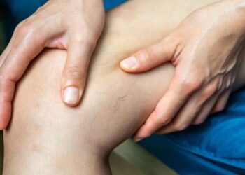 A trombose venosa profunda é provocada pela formação de um coágulo no interior de uma veia, podendo dificultar ou até mesmo obstruir o retorno do sangue ao coração Boy_Anupong/GettyImages