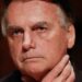 Bolsonaro deve ser transferido para hospital em Brasília nesta segunda (6), diz Eduardo