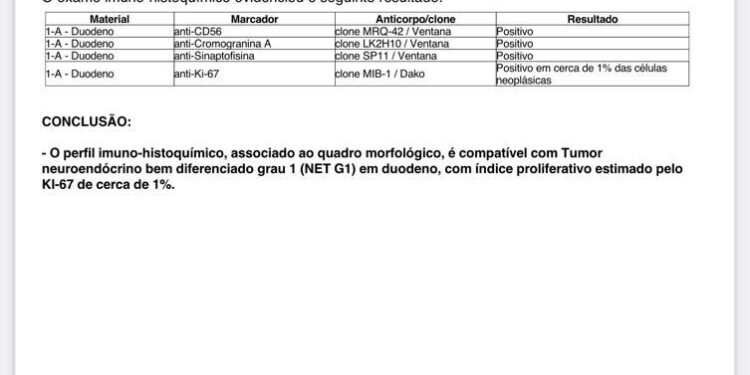 Janad é vítima de fake news sobre sua doença e aciona jurídico para abrir investigação