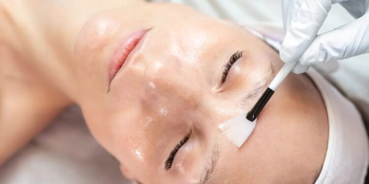 Peeling: veja os diferentes tipos e os cuidados que cada procedimento exige