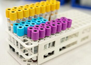 O exame de PCR é feito a partir da coleta de amostra de sangue e pode ajudar no diagnóstico de doenças infecciosas e processos inflamatórios alvarez/GettyImages