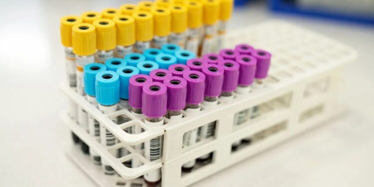 Proteína C Reativa (PCR): o que é, para que serve e quando fazer o exame