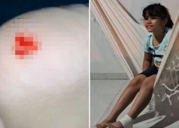 Nicolly estava com a mãe Judite Lorrane dos Reis na Praia do Caju quando foi ferida — Foto: Divulgação