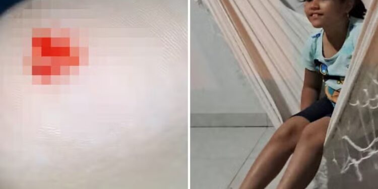 Criança é atacada por piranha em praia, e mãe reclama da falta de manutenção das telas de proteção: ‘Está tudo solto’