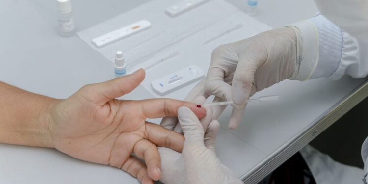 Semus ofere exames para detecção de hepatites virais