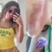 Anitta é queimada por água-viva em Ibiza: “Dor que nunca senti na vida”