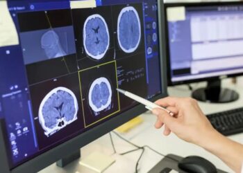 Estudo descobriu que a Covid-19 e a esquizofrenia podem afetar o cérebro de formas semelhantes
Luis Alvarez/Getty Images