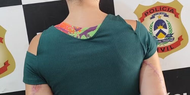 Suspeita de golpe do falso pix deixou clínica antes de receber alta para crime não ser descoberto, diz delegado