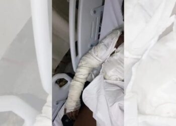 A jovem publicou que reagiu e pegou uma tesoura para se defender. Ao mesmo tempo, a suposta agressora jogou uma panela de óleo quente nela. Reprodução/Redes sociais