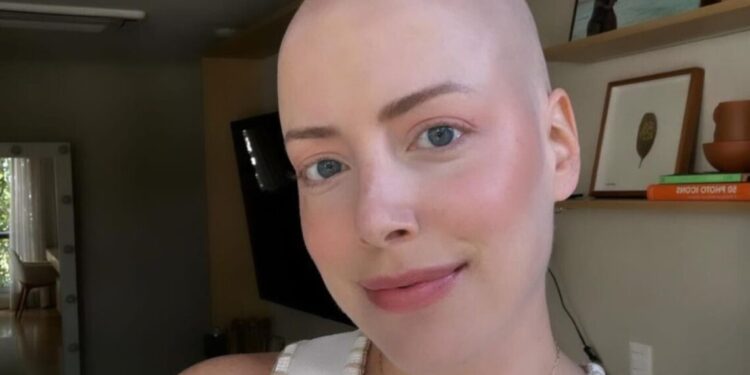 Fabiana Justus revela que já sofreu um aborto: “Muito difícil”