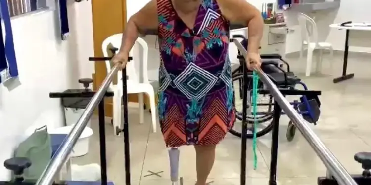 SES-TO realiza medições e entrega de próteses ortopédicas para pacientes do Serviço Especializado em Reabilitação em Araguaína