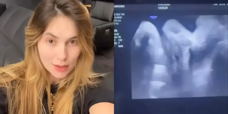 Grávida de 8 meses, Virginia mostra novo ultrassom do terceiro filho