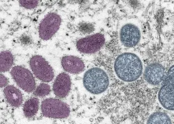 Organização Mundial da Saúde declara emergência global sobre o atual surto de mpox
Smith Collection/Gado/Getty Images