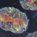 Mpox pode causar pandemia? Veja o que dizem especialistas