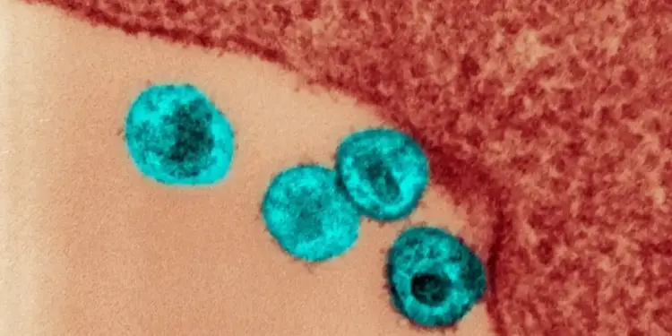 HIV: nova variante está circulando em três estados do Brasil, diz estudo