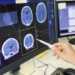 Doenças neurodegenerativas: o que são, sinais de alerta e como diagnosticar