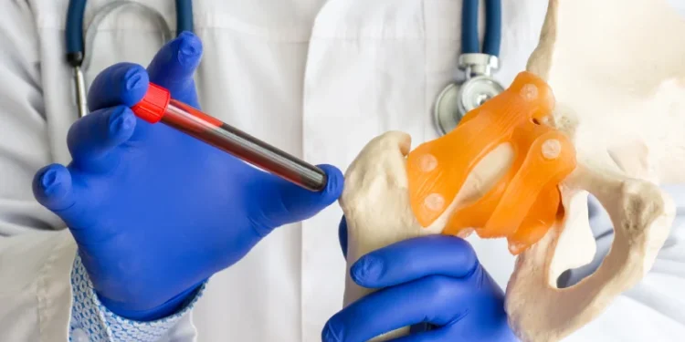 No Dia Mundial do Doador de Medula Óssea, SES-TO agradece os voluntários