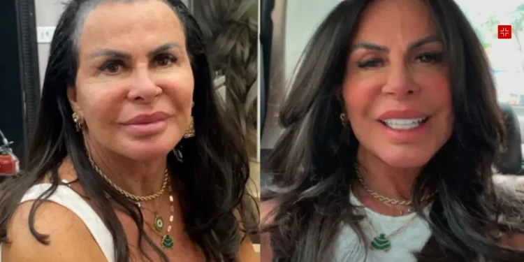 Gretchen mostra transformação do visual ao colocar nova prótese capilar