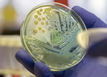 Bactéria multirresistente pode causar diferentes tipos de infecções associadas à assistência à saúde, incluindo pneumonia, infecções da corrente sanguínea e meningite • Rodolfo Parulan Jr./Getty Images