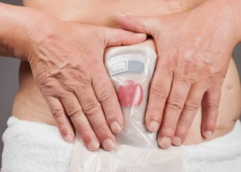 Aproximadamente 30.000 bolsas de colostomia bolsas de colostomia já foram distribuídas pelos SCER’s