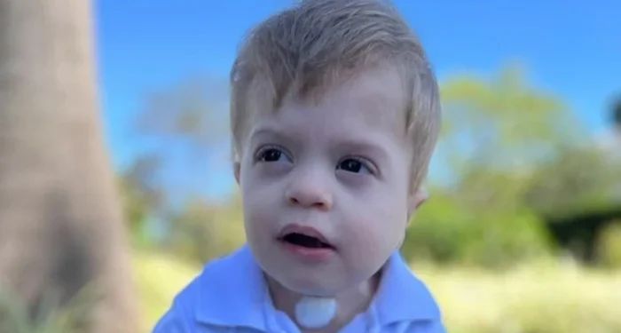 “Vivi no modo sobrevivência”, diz mãe após bebê passar por 7 cirurgias