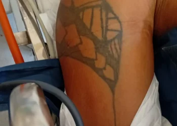 Paciente sem identificação HGP. Foto Divulgação SES-TO