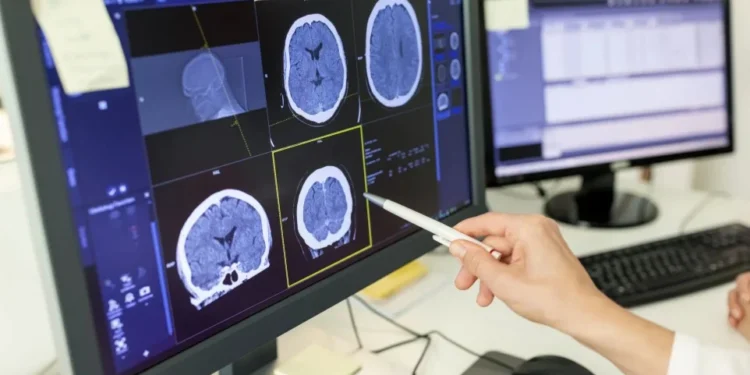 Ciclo menstrual leva a alterações estruturais no cérebro, diz estudo