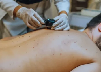 O câncer de pele não melanoma representa 30% de todos os tumores malignos registrados no Brasil, de acordo com o Inca (Instituto Nacional do Câncer) • LordHenriVoton/GettyImages