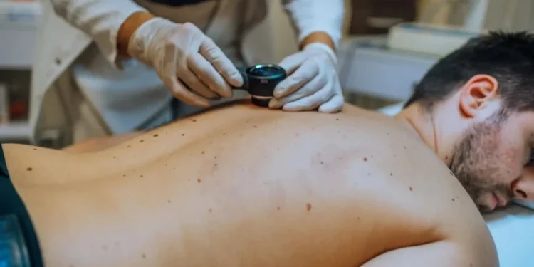 Dezembro Laranja: veja 12 mitos e verdades sobre câncer de pele