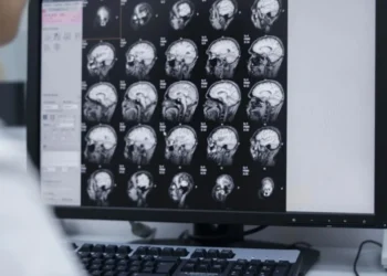 Hemorragia intracraniana é um sangramento que ocorre no cérebro devido a quedas ou traumas, e pode ser detectada por exames de imagem • Freepik