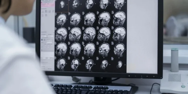 O que é hemorragia intracraniana e quais são as causas? Entenda