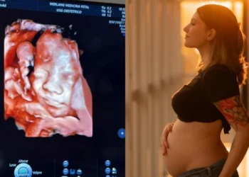 A imagem mostra o rostinho do menino Artur, que tem previsão de nascer entre 32 e 34 semanas de gestação • Instagram/Isabel Veloso