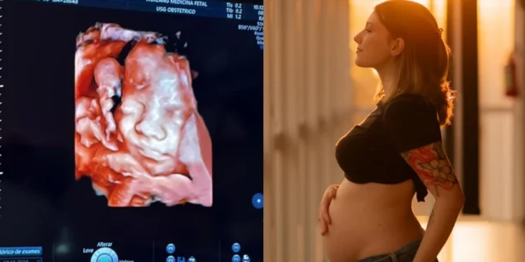 Isabel Veloso mostra ultrassom de primeiro filho: “Lindo demais”