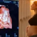 Isabel Veloso mostra ultrassom de primeiro filho: “Lindo demais”